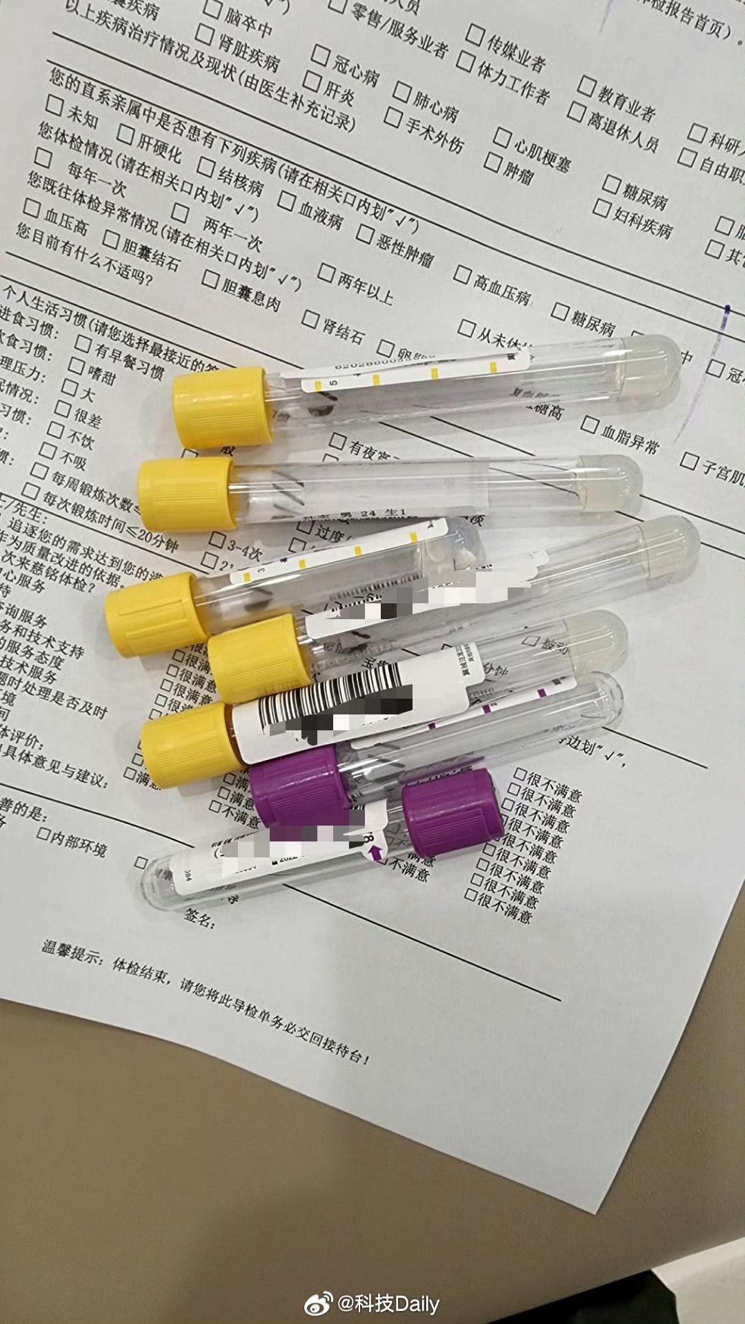 免费体检后花了20万报告竟是假的 这么坑？不应该严查么，一定要避免被体检套路，万