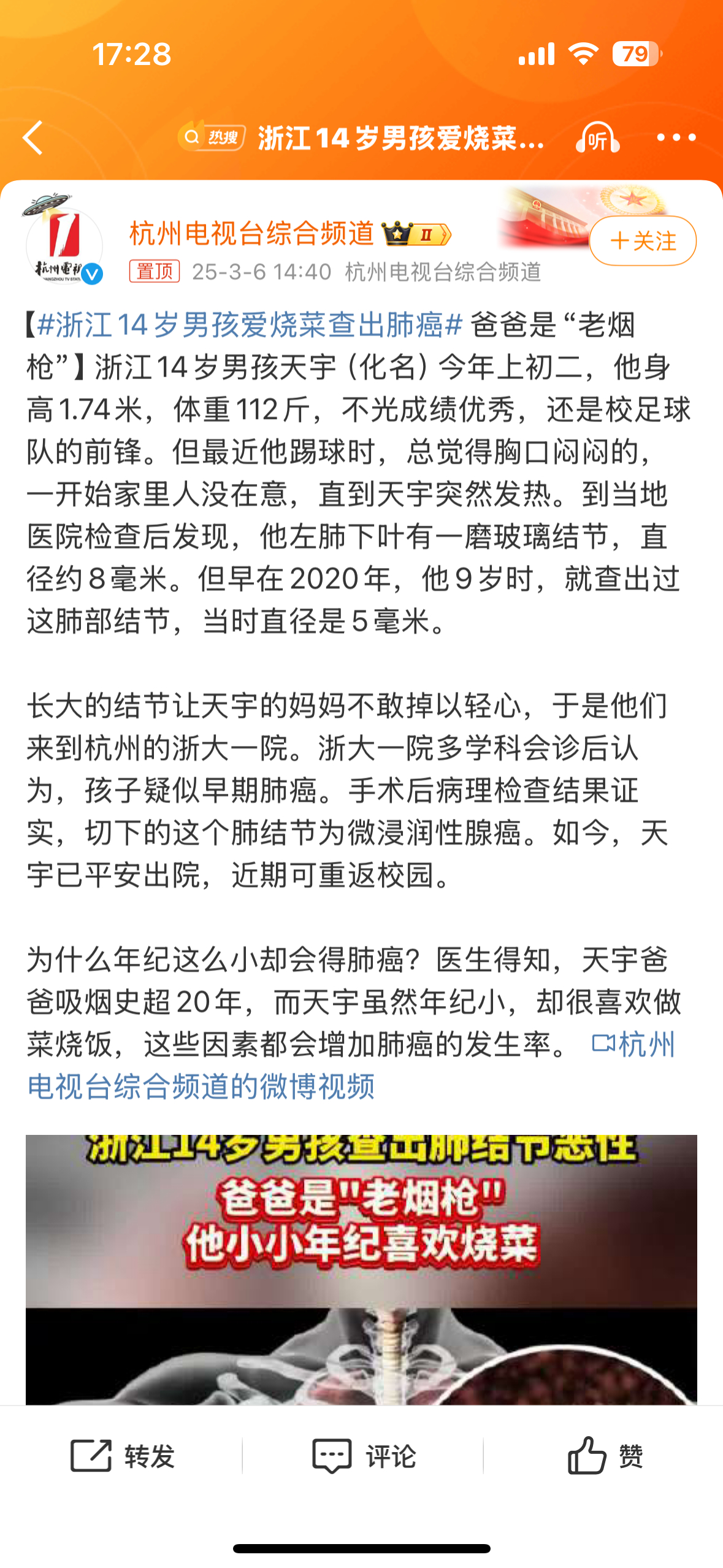 这个话题一直也想说说，我们国家的肺癌率和女性非吸烟人群的肺癌率相对国际水平是更高