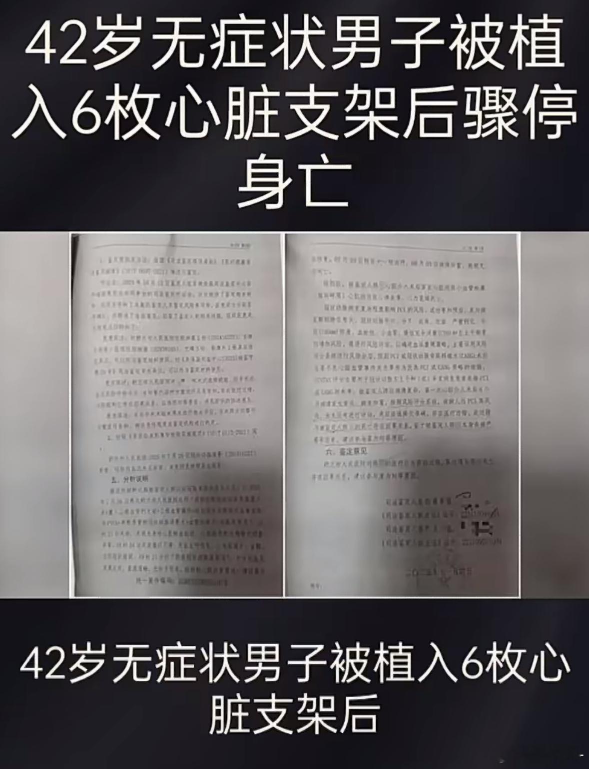男子一次性植入6个心脏支架后去世这位大哥是不是认识于北辰将军啊？做一个多活十年，