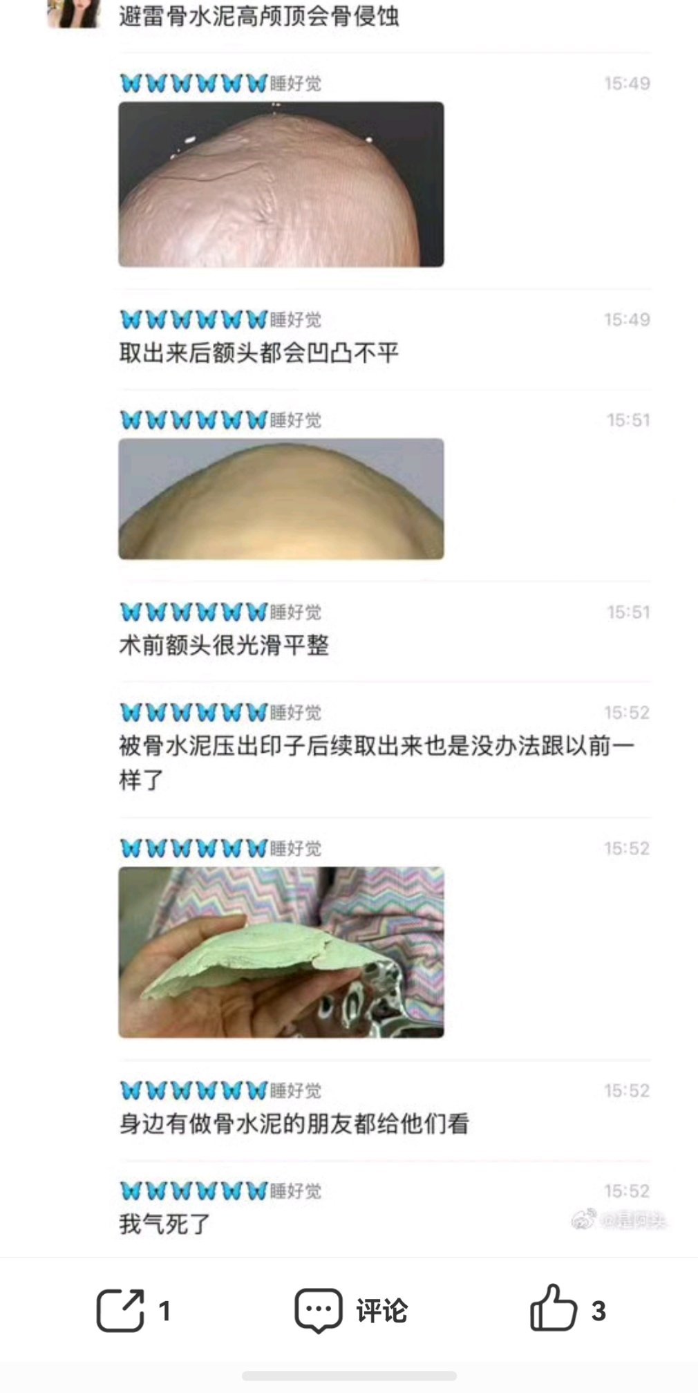 人间观察 刷到一个整圈博主发出来的骨水泥高颅顶手术，据说很多女人跑韩国去做送我5