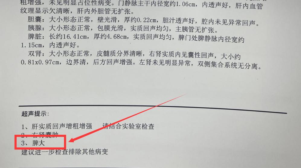 肝病患者彩超提示脾大，其实是好事！。脾大在很多肝硬化病人身上常见，为什么说乙肝病人出现脾大是好事呢？因为脾大是肝硬化的早期表现，说明你的病情正在持续进展，当肝病患者做彩超或CT、磁共振等影像学提示脾大时，说明有肝硬化的倾向，这时做血常规检查血小板可能还不会出现明显降低，这个时间我们就需要重视，在治疗病因的同时进行抗纤维化治疗，才能延缓病情进展、才能不发展到肝硬化失代偿期。