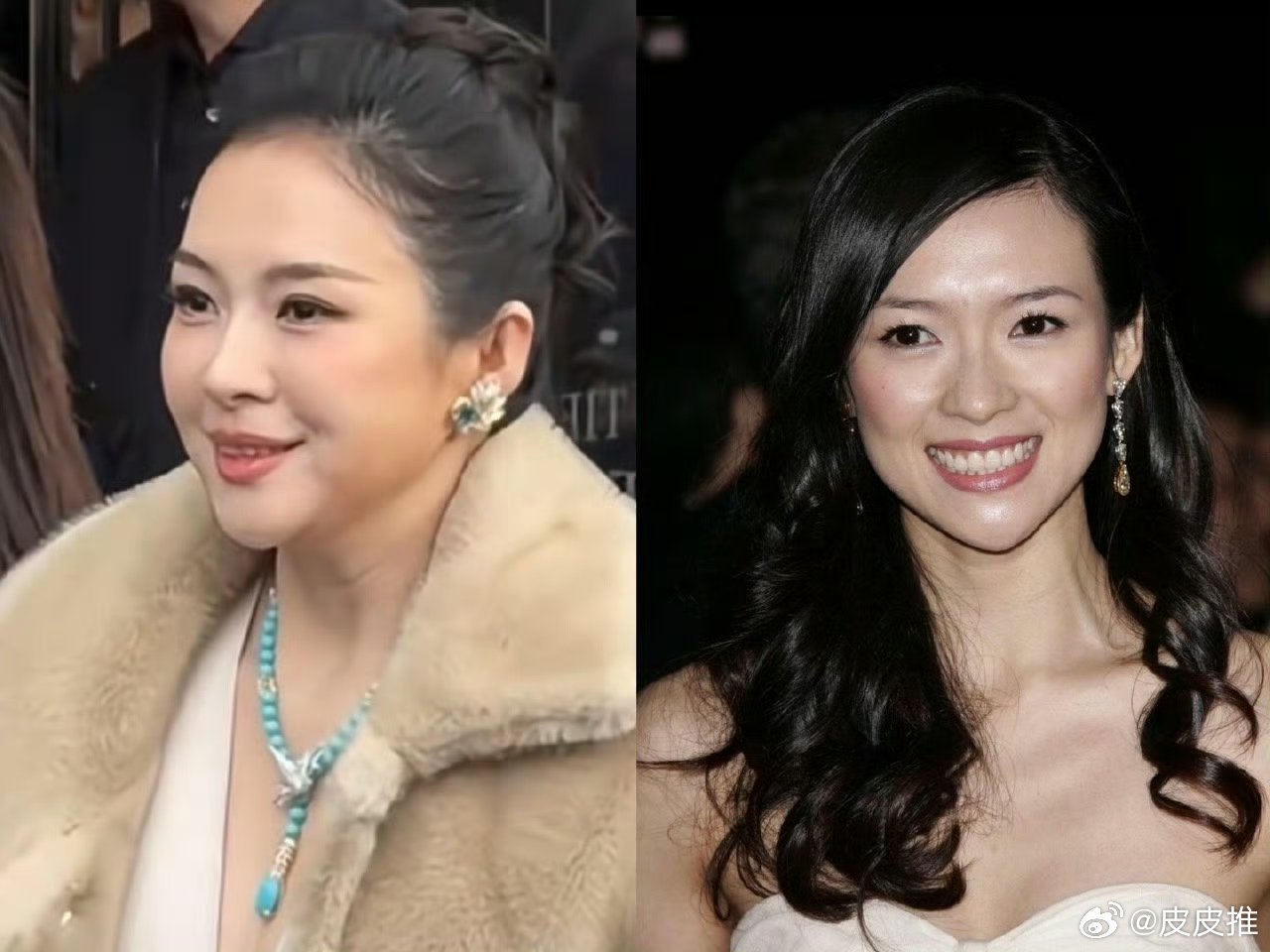 章子怡应该没做医美，她这是为新戏增肥了，看她脸颊上的肉显而易见变多了，你别说这样