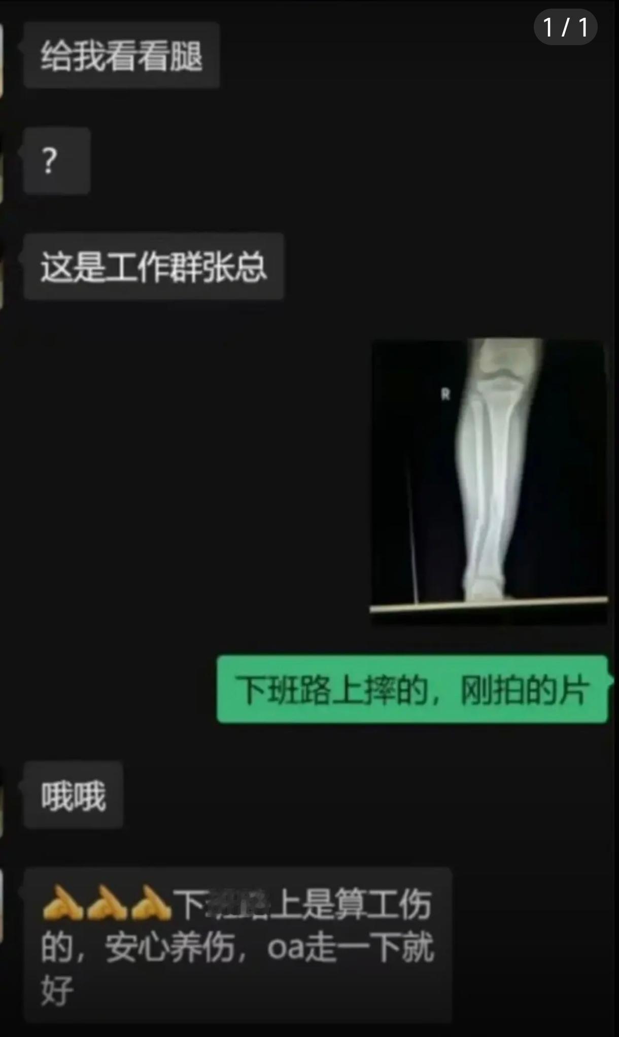 幸好只是要看腿啊......
不然要看点其他的，我都替他尴尬了。
不过，以这个人