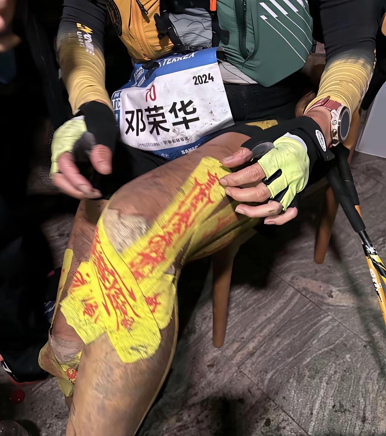 这位马拉松选手，一看就知道是“专业人士”，把这几张经过特殊加工过的黄皮贴贴上去后