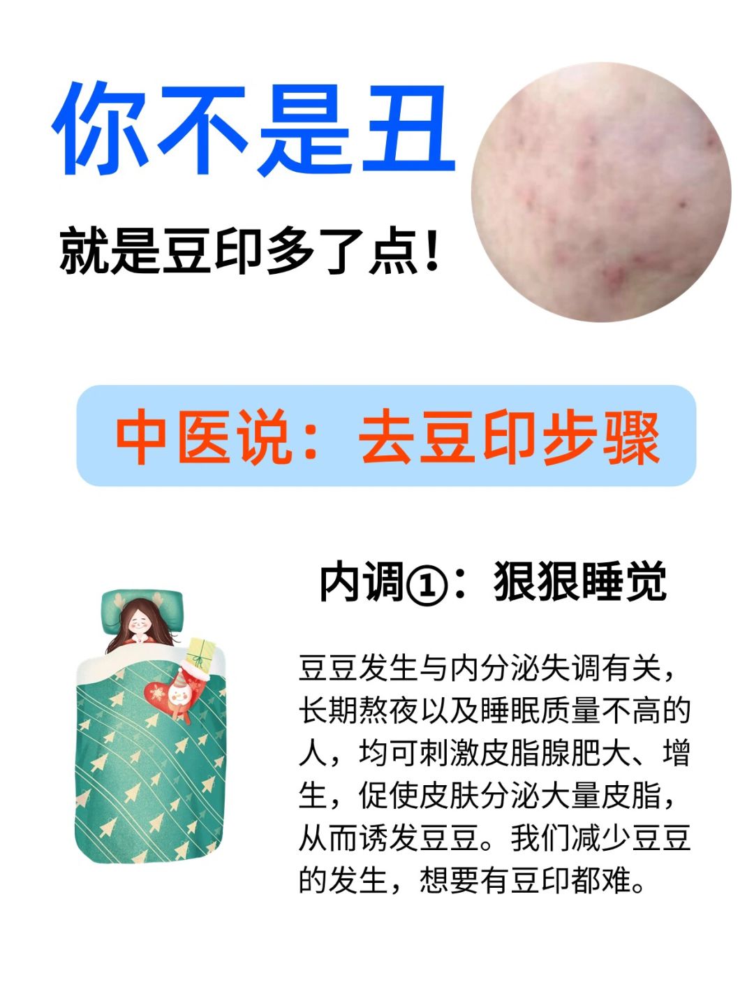 平时豆印太多，7个简单护理方式，记得学