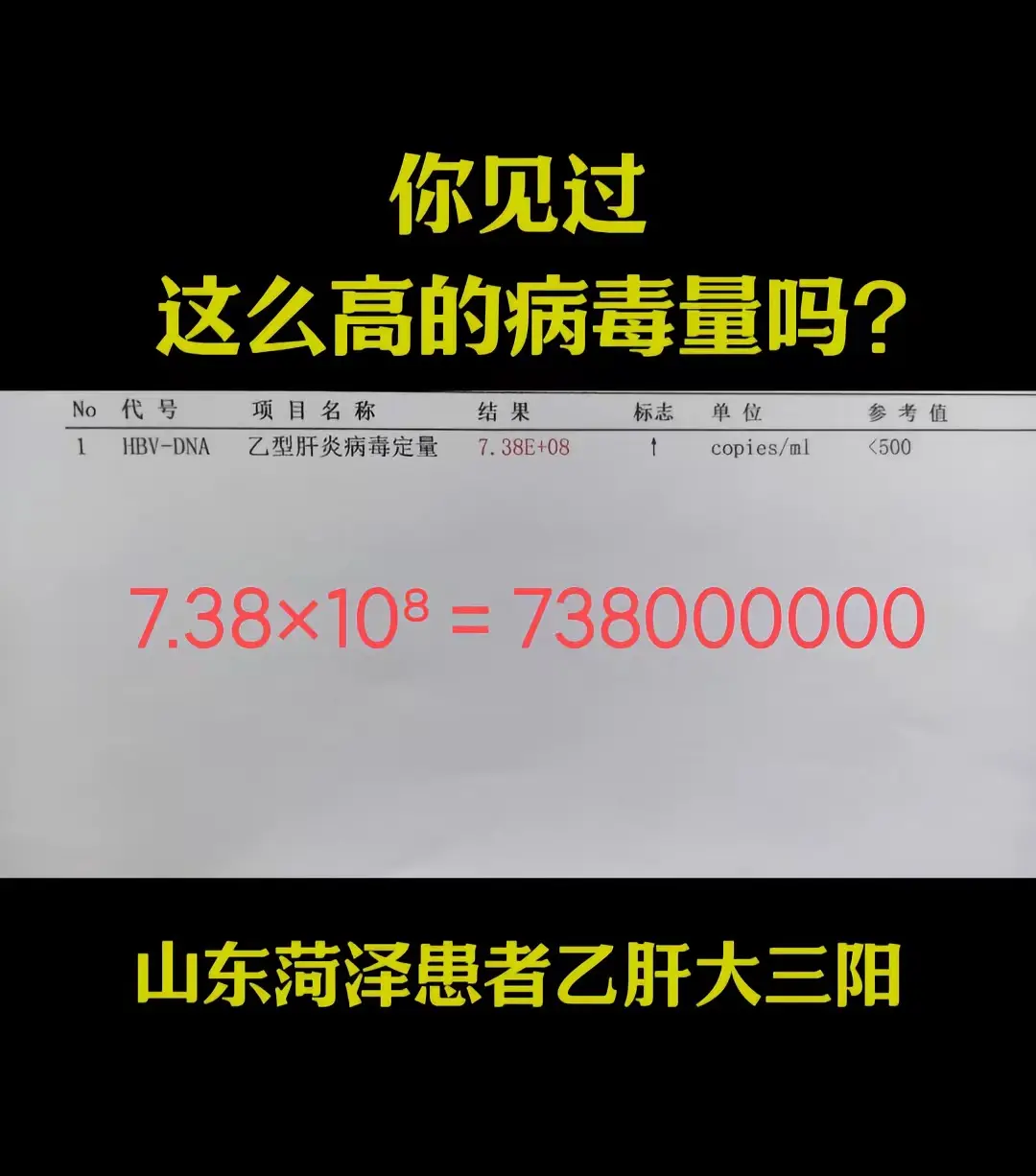 乙肝病毒量从“上亿”到0！3个方案坚持3个月，很多人也在做！  1、规...