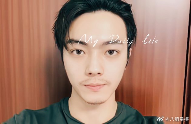许凯这事儿，​最着急害怕的不是他本人，更不是于正和前女友。​而是投资方啊。​投资