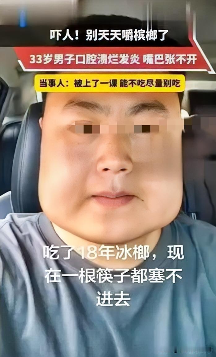 18年槟榔不离口，男子终尝恶果！张先生从20岁起每天嚼食槟榔，近期口腔溃烂、张口
