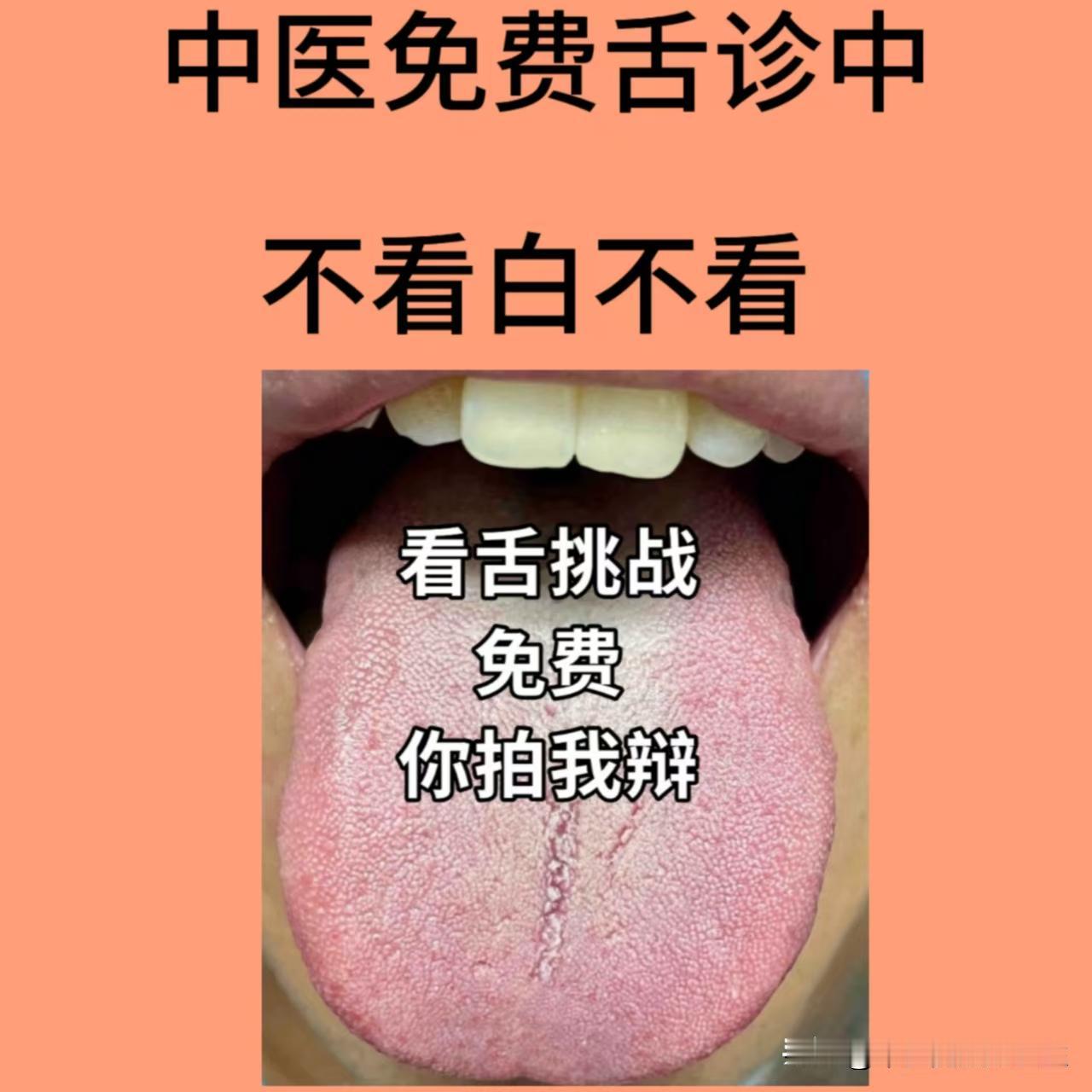 大家早上好！今天挑战帮66个人看舌象！

想要找我辨证舌象的朋友，尽管发！你发我