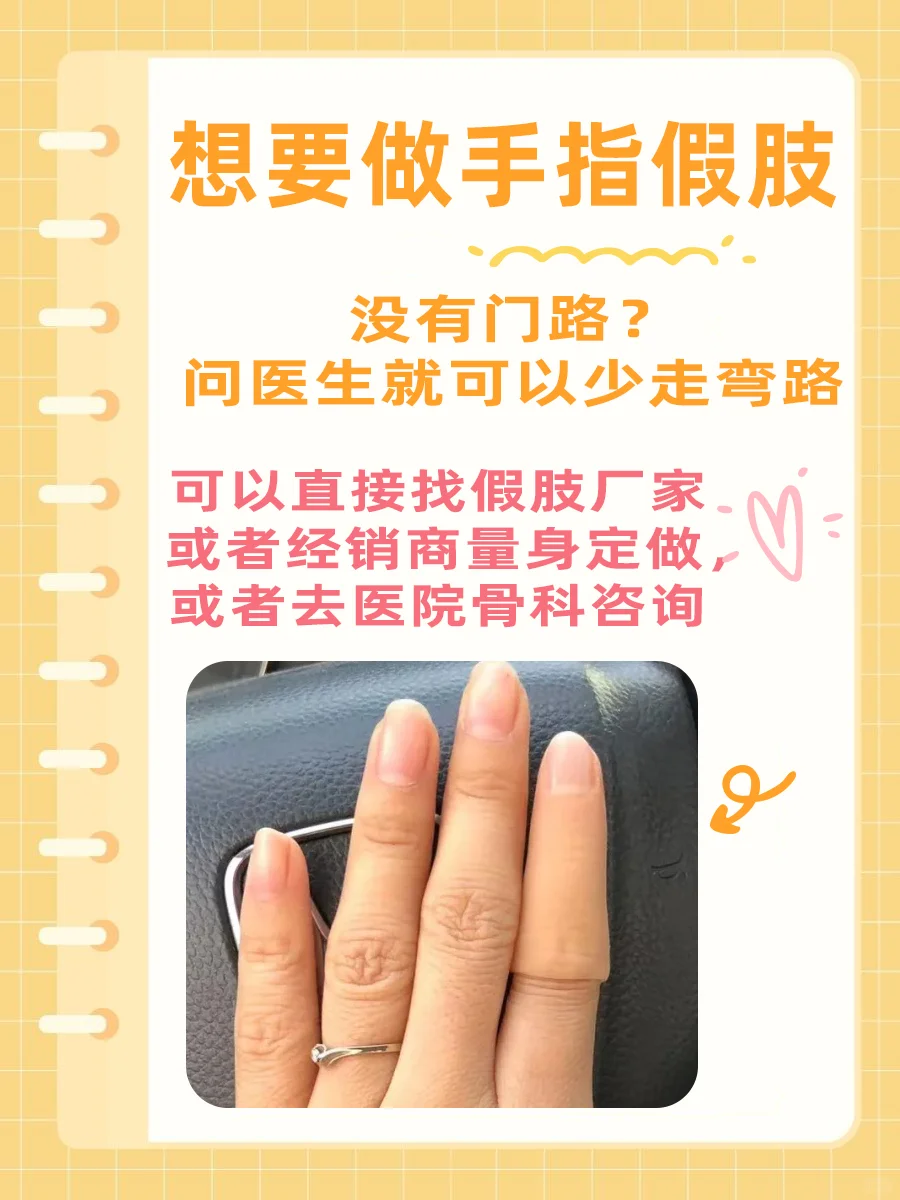 手指假肢去哪做