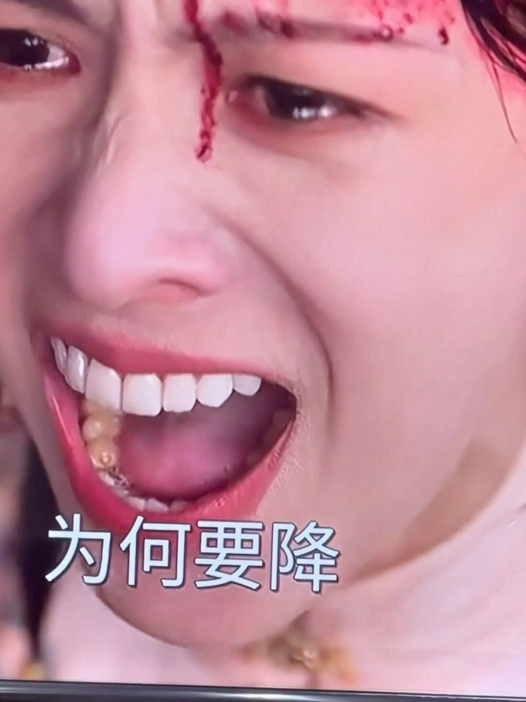 明星真的不能做牙齿贴片 ​​​