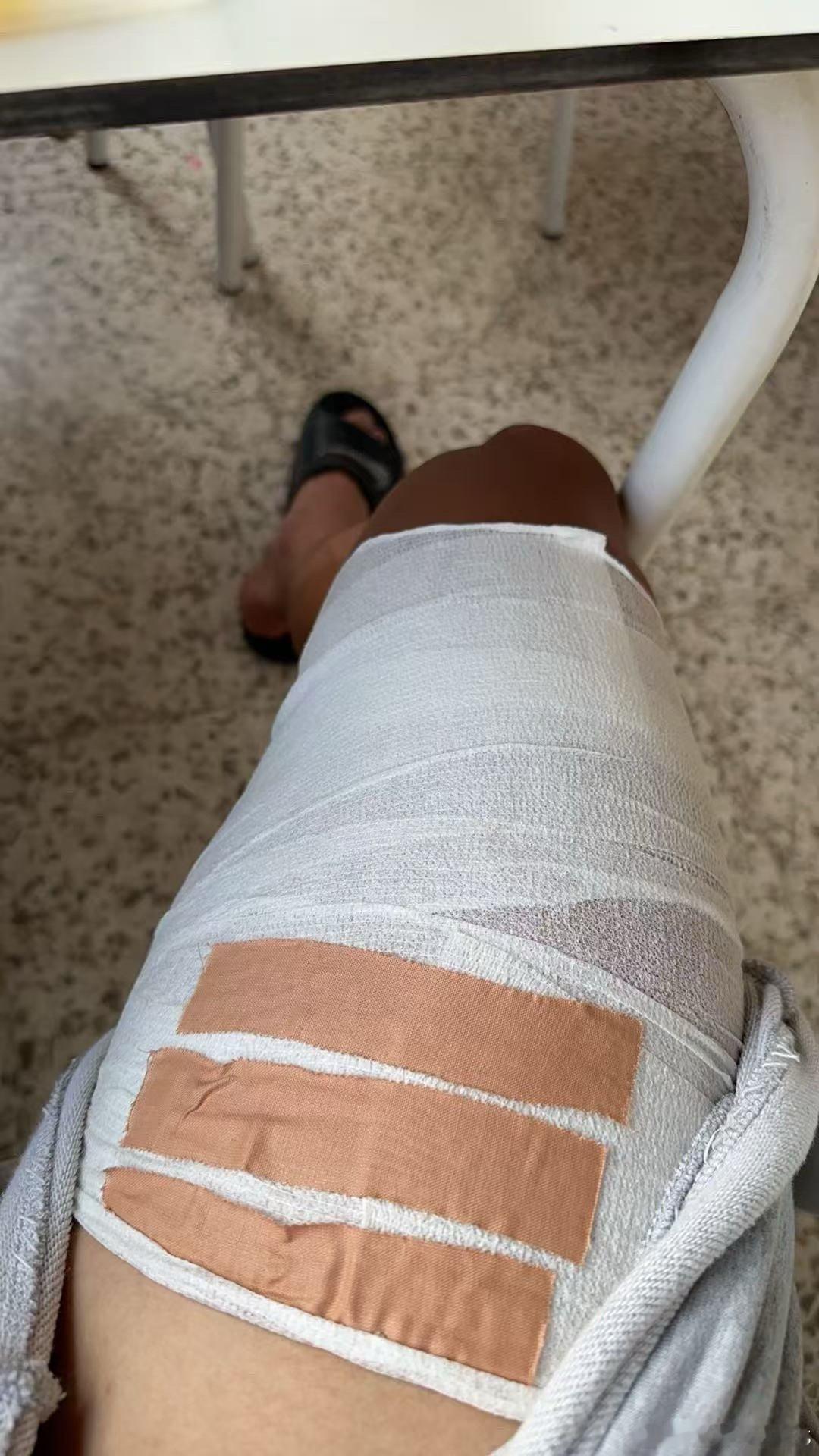 上一场热身赛场地太差，马贝拉队里多人出现伤病，杜月徵股四头肌轻微撕裂，预计缺席2