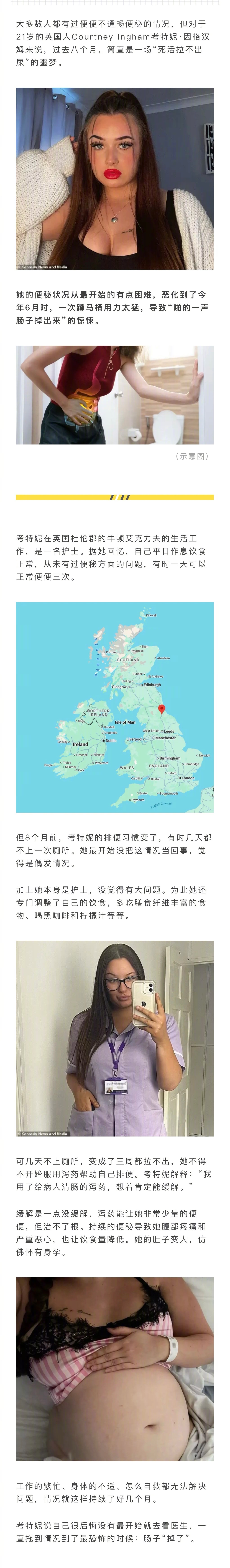 英国21岁女子严重便秘8个月之久，一次吃完泻药蹲坑用力过猛，竟然听到“啪”的一声