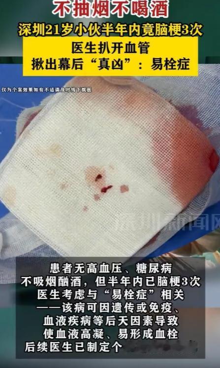 “万万没想到！”7月23日报道，广东深圳，一小伙因脑梗死被送去医院抢救，手术成功