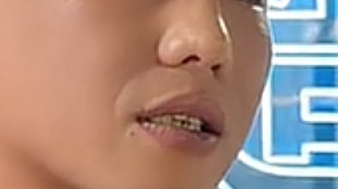 在一对一面相思维学习里面，我又为法令纹割鼻翼加入了不一样的注解，分1和2共两篇，