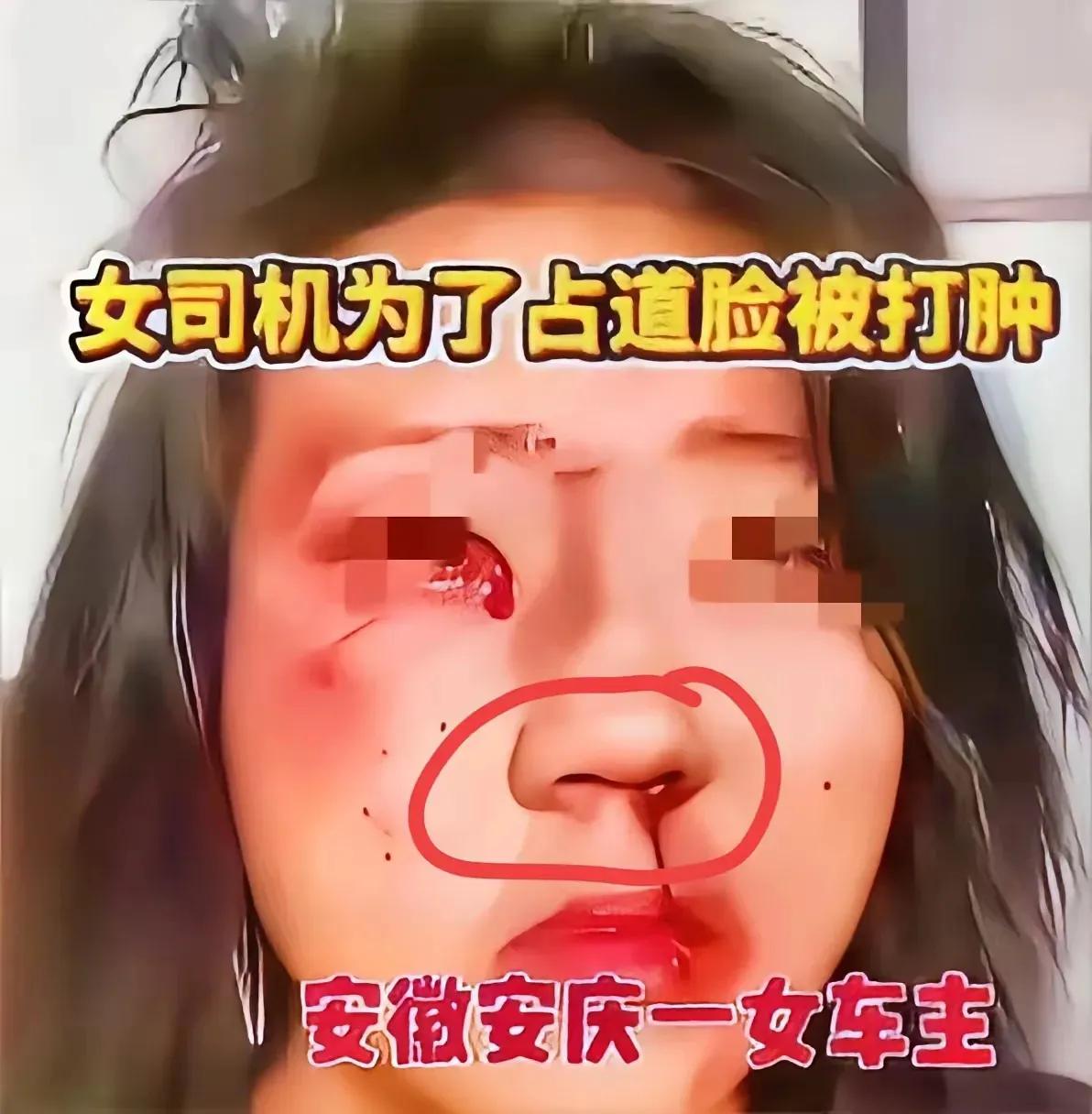 这两天后台被问蕞多的就是那个 25 码龟速度 8 公里还嚣张挑衅的事儿我刷到这事