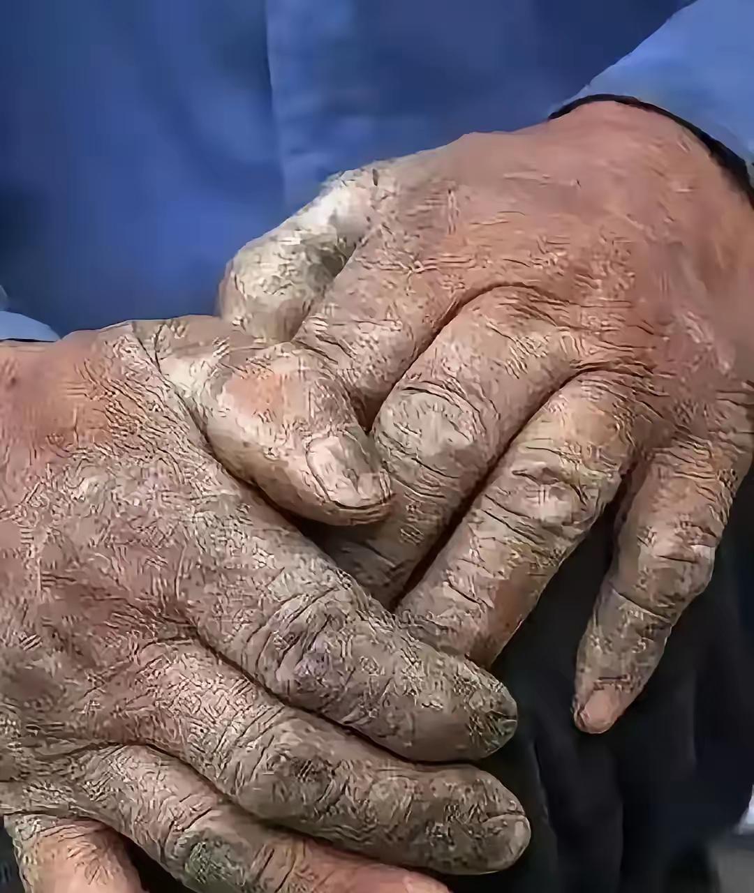 云南18岁孤儿被中介忽悠去广东砍树，干了三四个月一分钱没见，只拿到一部旧手机。