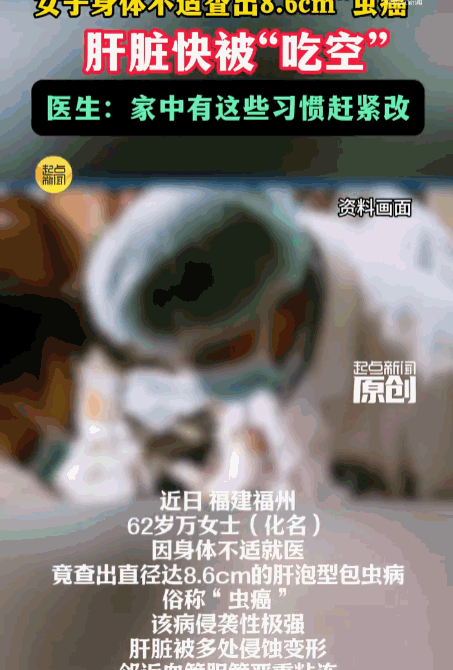 悲剧还是发生了！福建一位62岁大妈，平日里身体硬朗，竟被医生告知，肝脏马上就要被