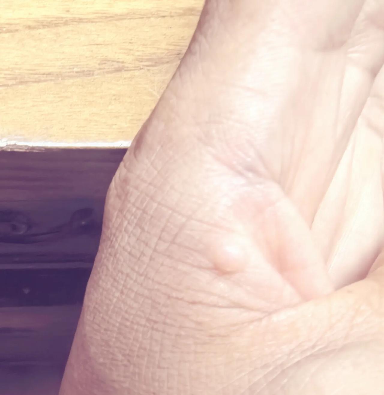 左手虎口有太阳的条友，有吗？