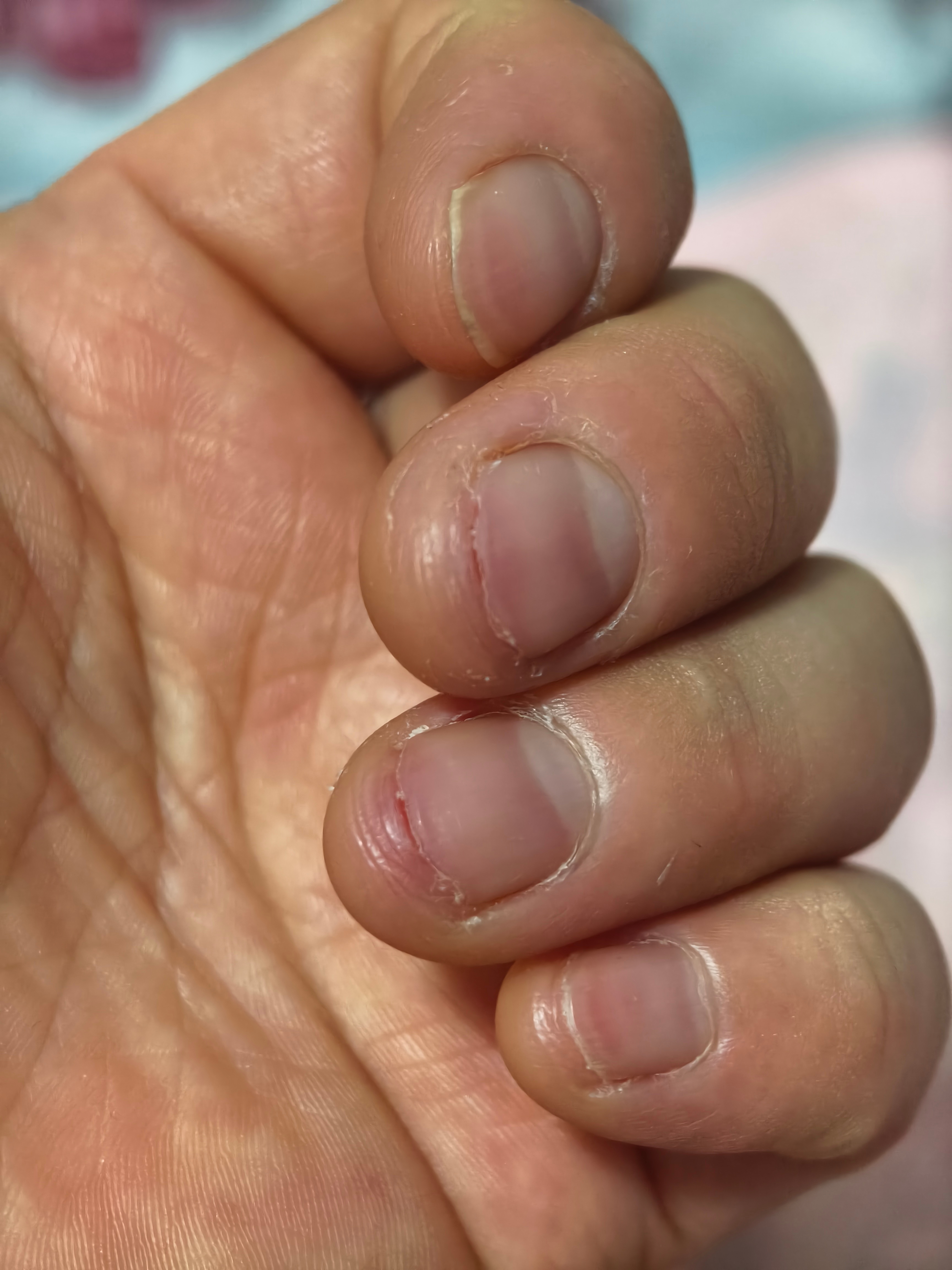 每次剪指甲最后都得弄成这样，老己你确定不是在给我上酷刑吗？[流鼻血][流鼻血][