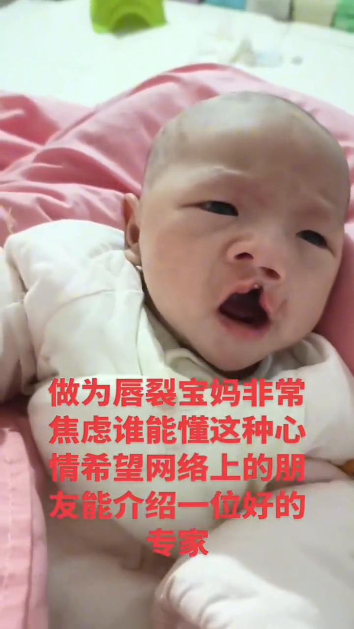 全网支持李亚鹏，让更多唇腭裂患者重获新生。
这是刚出生的婴儿，新生婴儿。做为唇裂