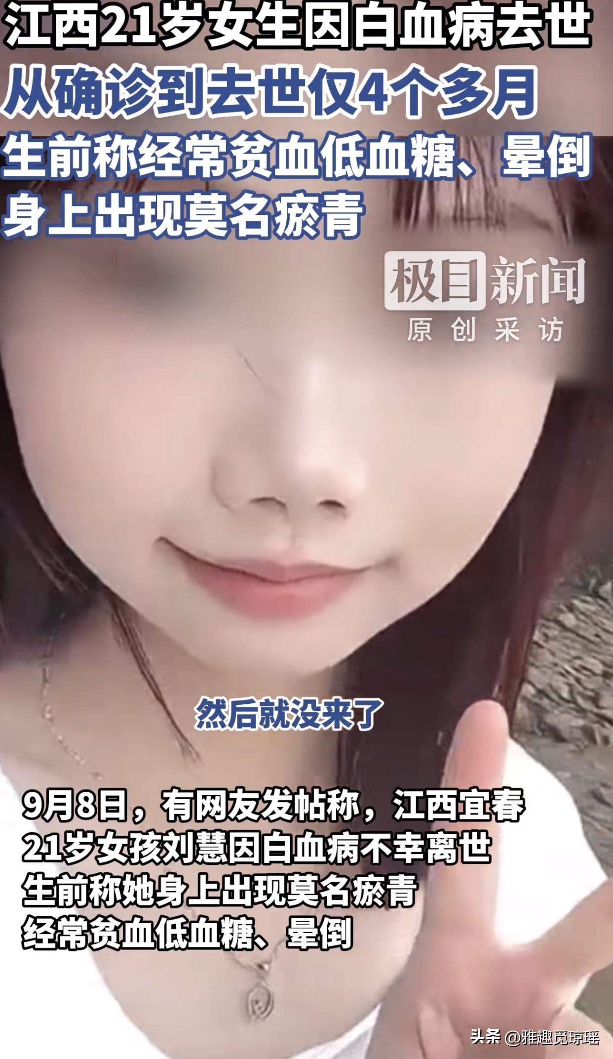 太可惜了！江西一21岁女生因白血病离世，生前淤青晕倒却未重视，从确诊到去世仅4个