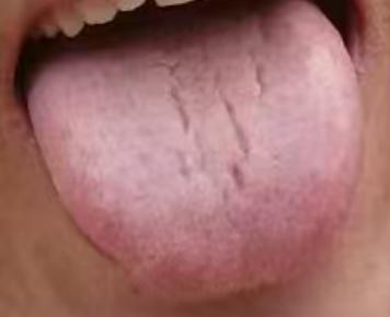 宗筋失养多因瘀堵，疏通气血，恢复良好状态






有不少朋友会遇到这样的困扰