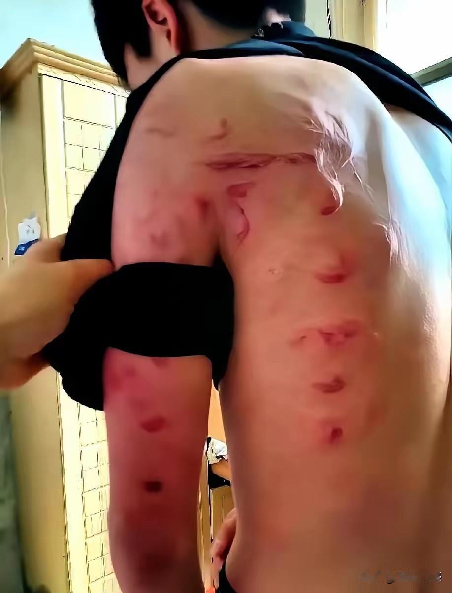 马上就要高考了，这小伙子由于痴迷于游戏，把父亲惹怒了，结果挨了一顿暴揍，实事求是