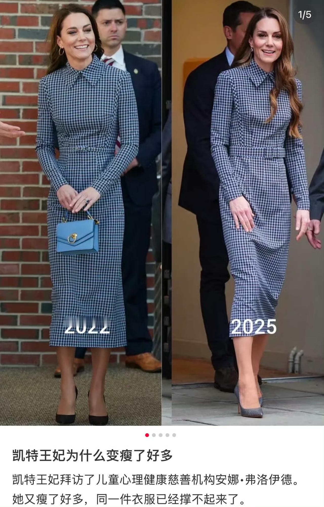 看得出来英国王室没什么能人了，43岁凯特王妃劳累患癌后断崖式衰老，瘦成纸片人！