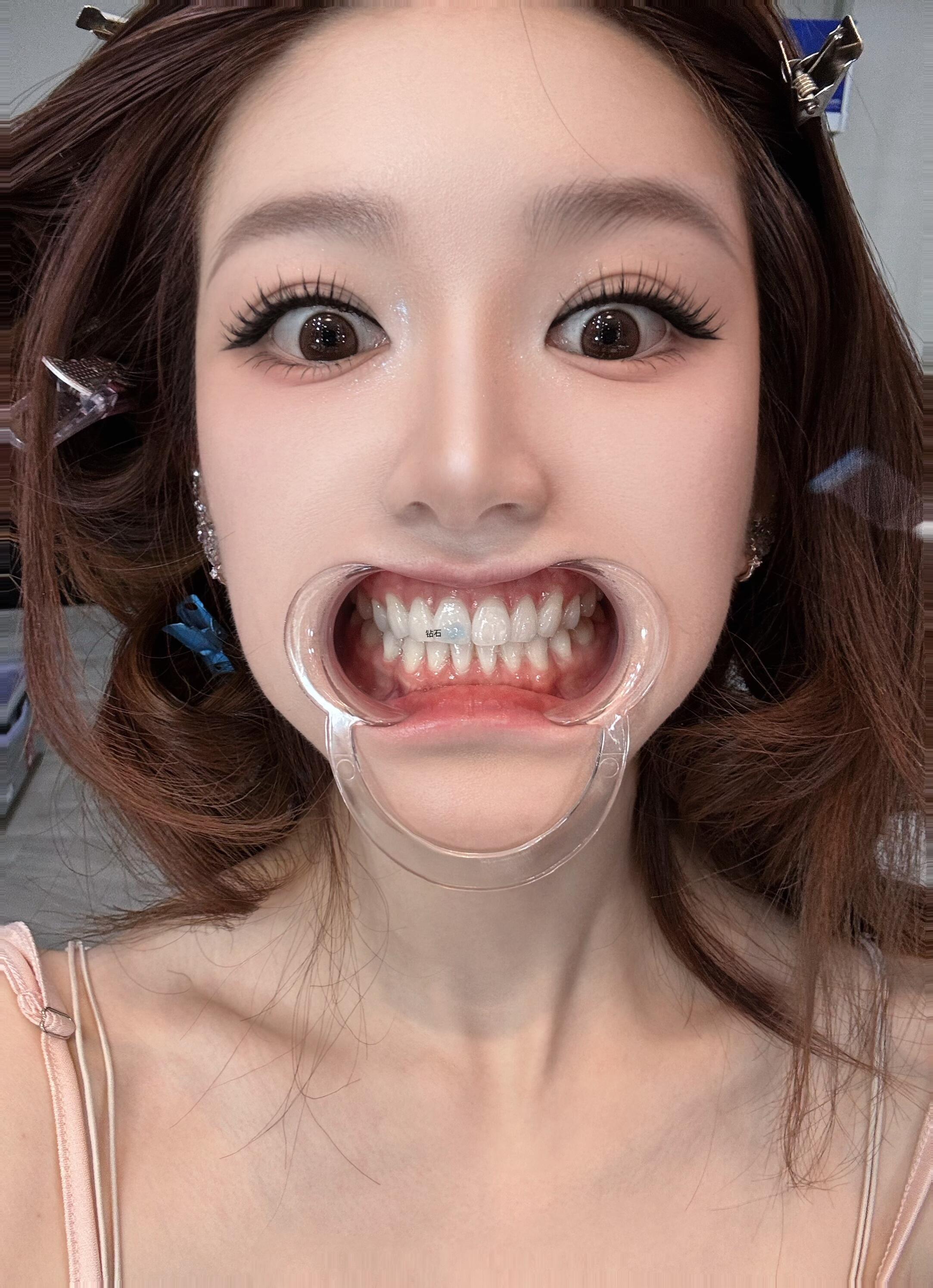 看🦷