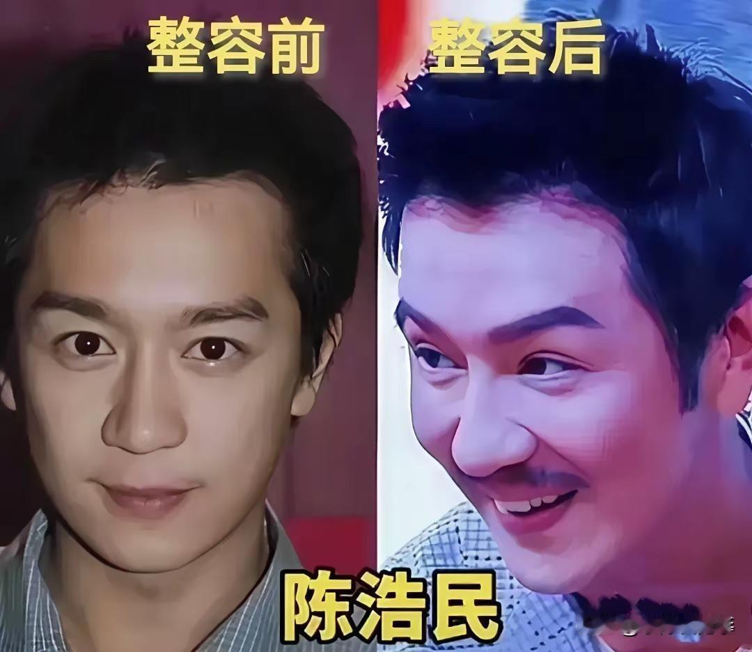 苏有朋、刘恺威、陈浩民、吴刚：这4位男明星整容前后，有人认不出来。

刘恺威从单