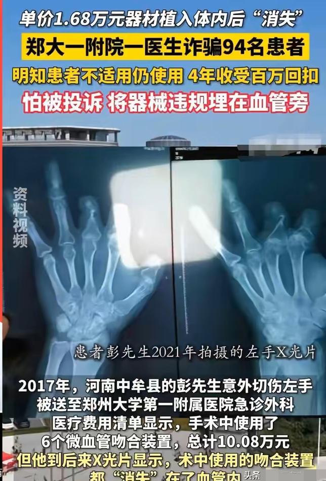 郑州大学第一附属医院有个叫王福建的医生，因为坑骗病人，最近被判了12年。

简单