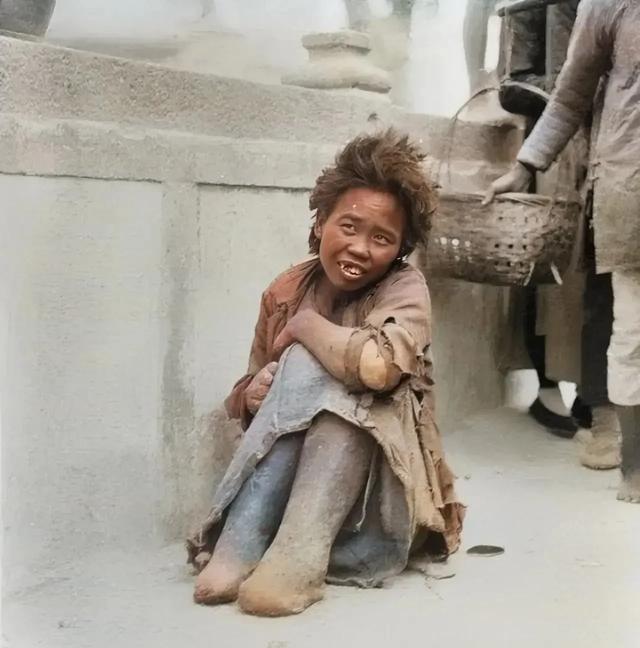 民国时期的一个麻风病人，她的双脚已经腐烂，看着挺恐怖的
话说民国时候，中国麻风病