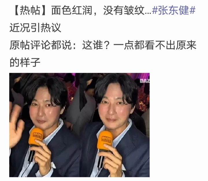 男演员保持年轻的秘诀应该是健身，而不是医美。 