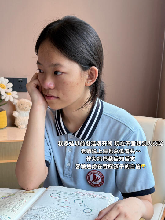 作为过来人 作为妈妈 我恨死了青春痘！