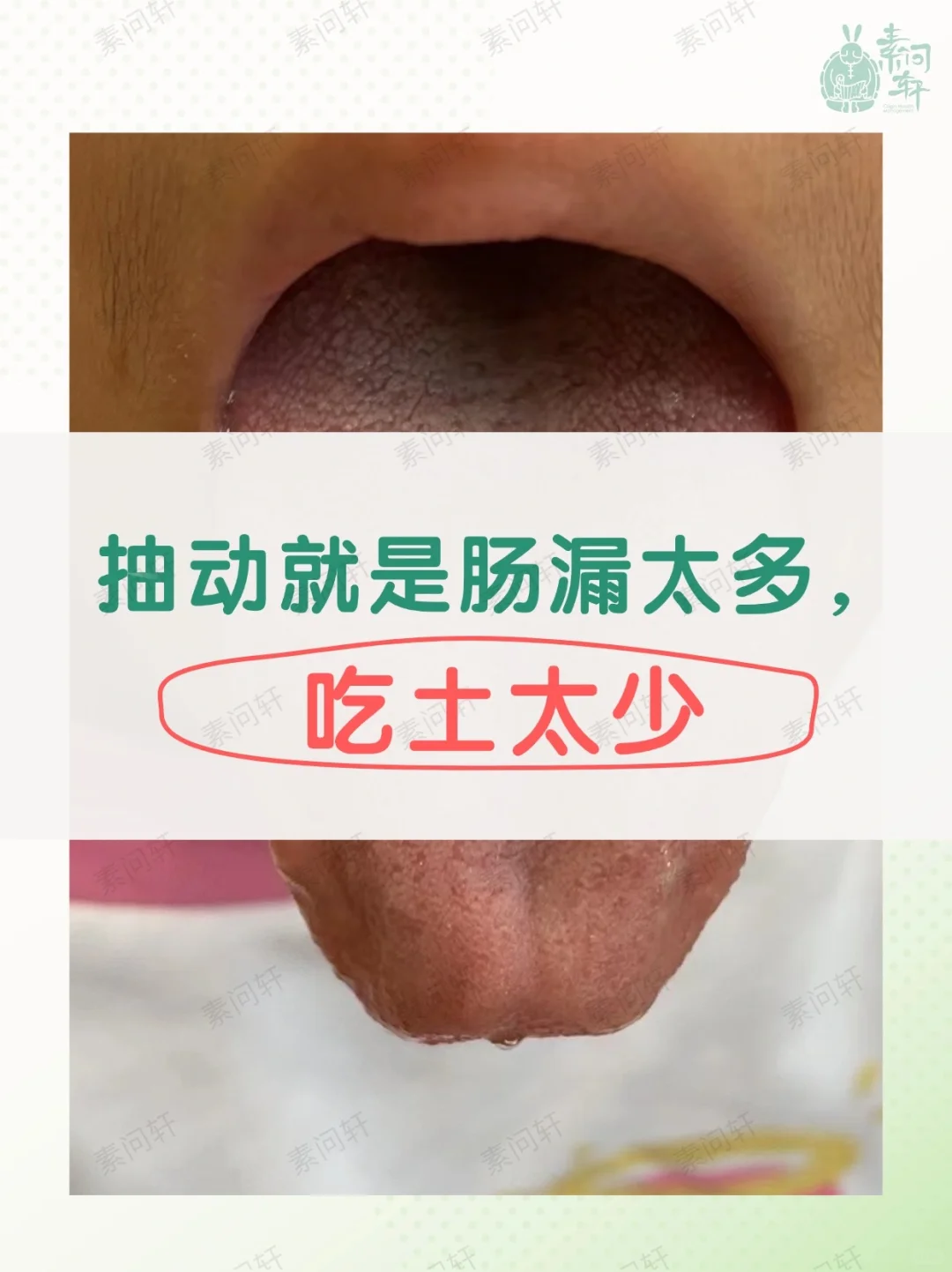 抽动就是肠漏太多，吃土太少