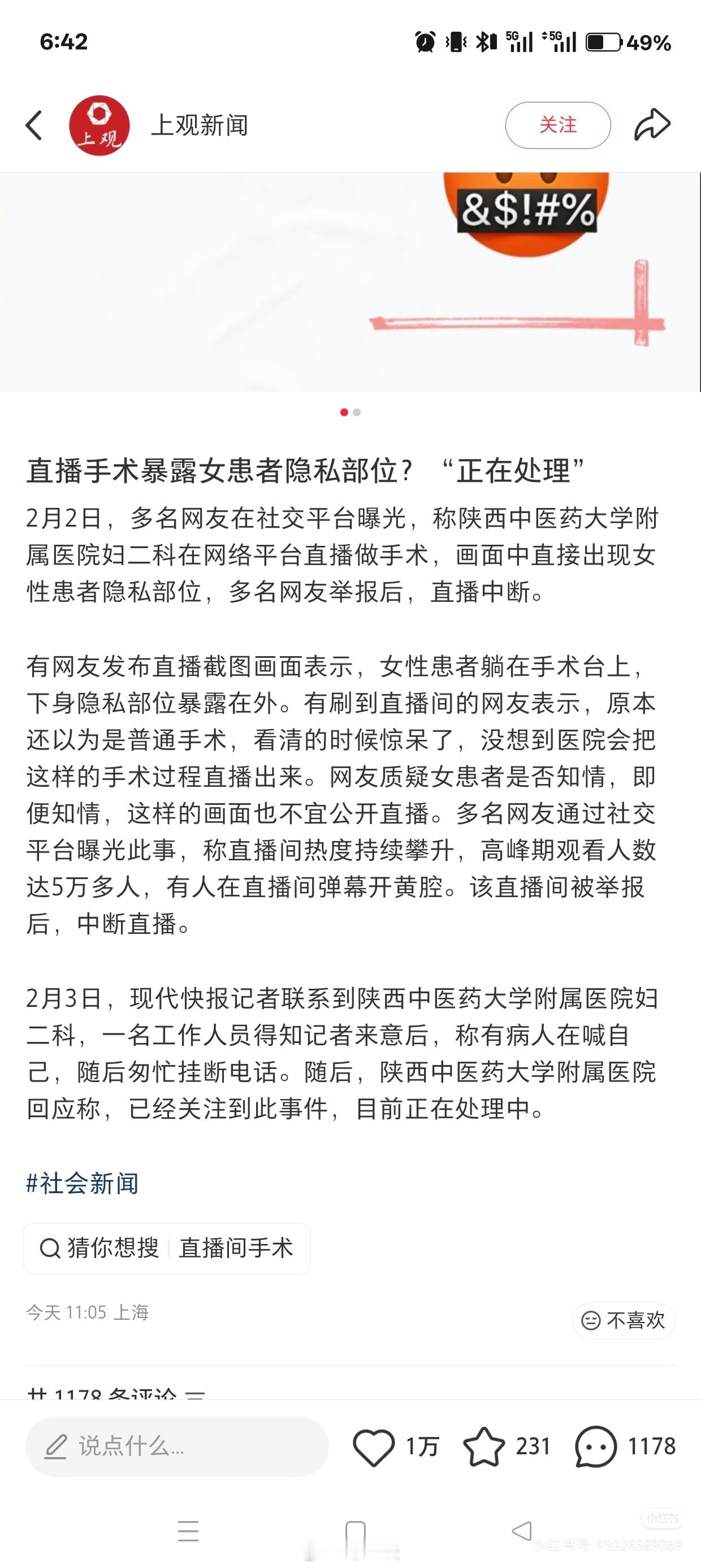 不能理解，这种手术不管怎么样都不应该公开直播吧，哪怕是教学视频，不也是只能在内部