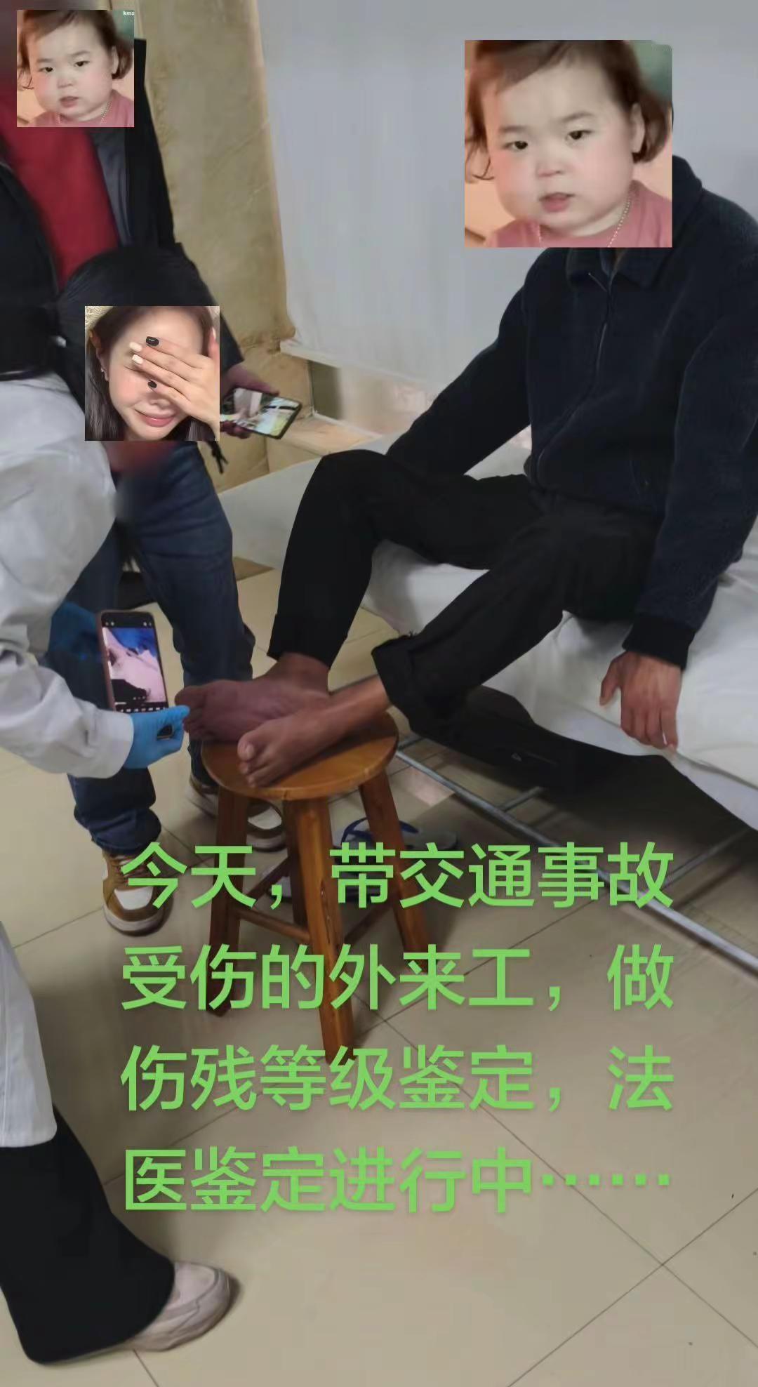 今天带交通事故受伤外来工，做伤残等级鉴定。今天，带交通事故受伤的外来工，做伤残等