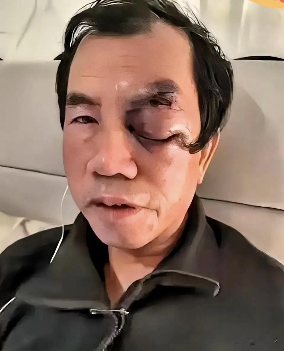 梁新民大概怎么也想不到，
那口让他魂牵梦萦的“甜美空气”，
竟成了他被打时，空气