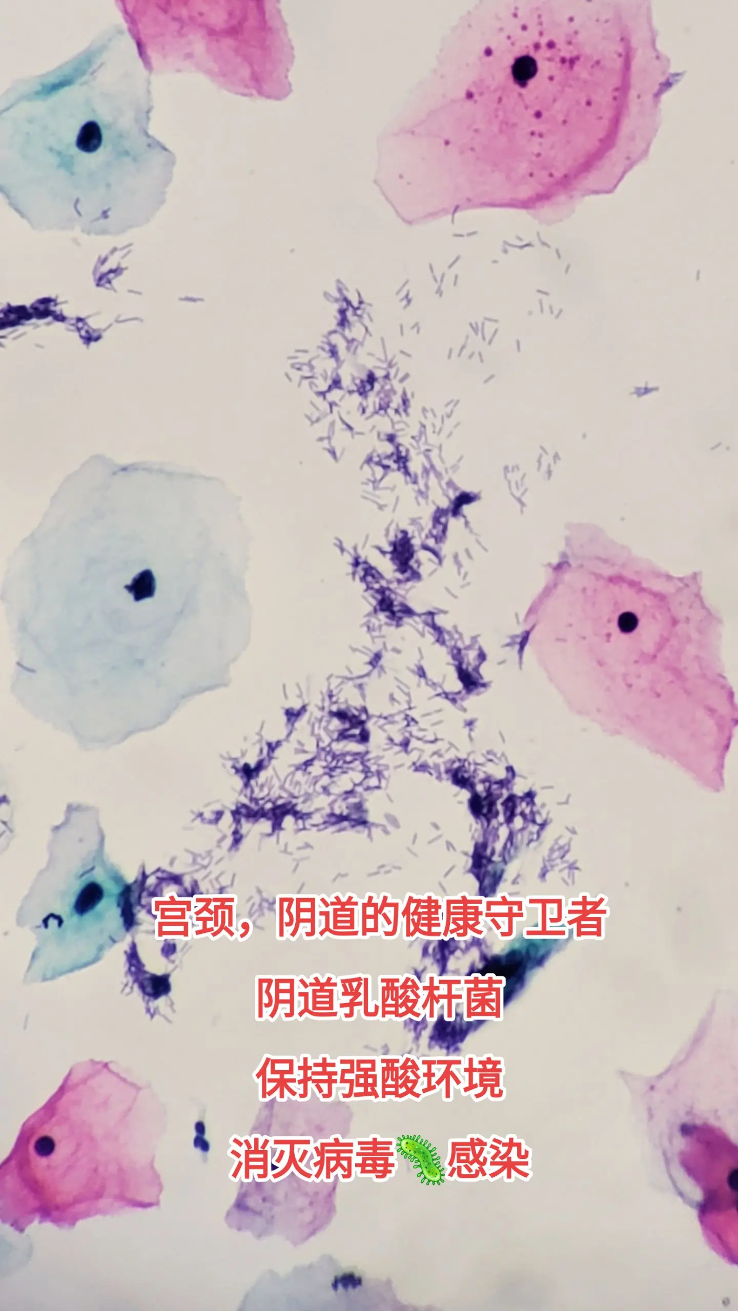 阴道乳酸杆菌
