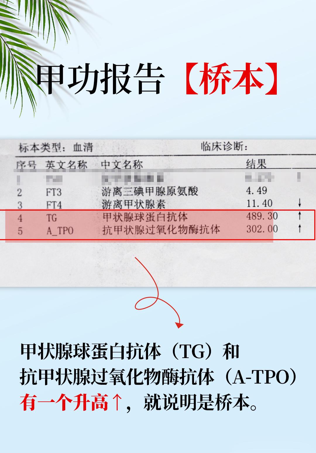 “神出鬼没”的桥本炎，有时候有，有时没有，怎么回事？？！！有个粉丝，让我帮看病例