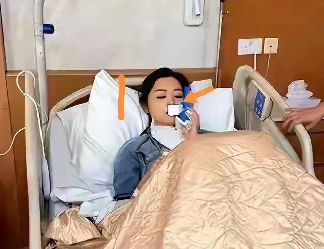 卫诗雅获奖前后对比：
图1：卫诗雅获奖前一天因拍戏嘴唇玻璃划伤缝合五十多针才拆线