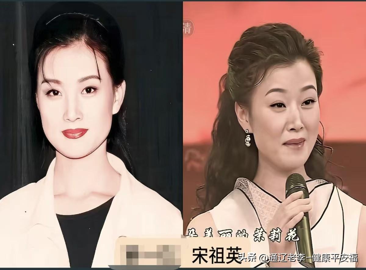 年轻时的歌唱家今昔同框，每一张都是岁月的回音！
一组照片，半部华语乐坛记忆。宋祖
