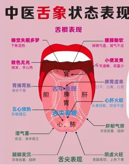 小舌像，大学问

留下你的舌头，我来帮你看看，你的身体是否健康。

舌头案例如果