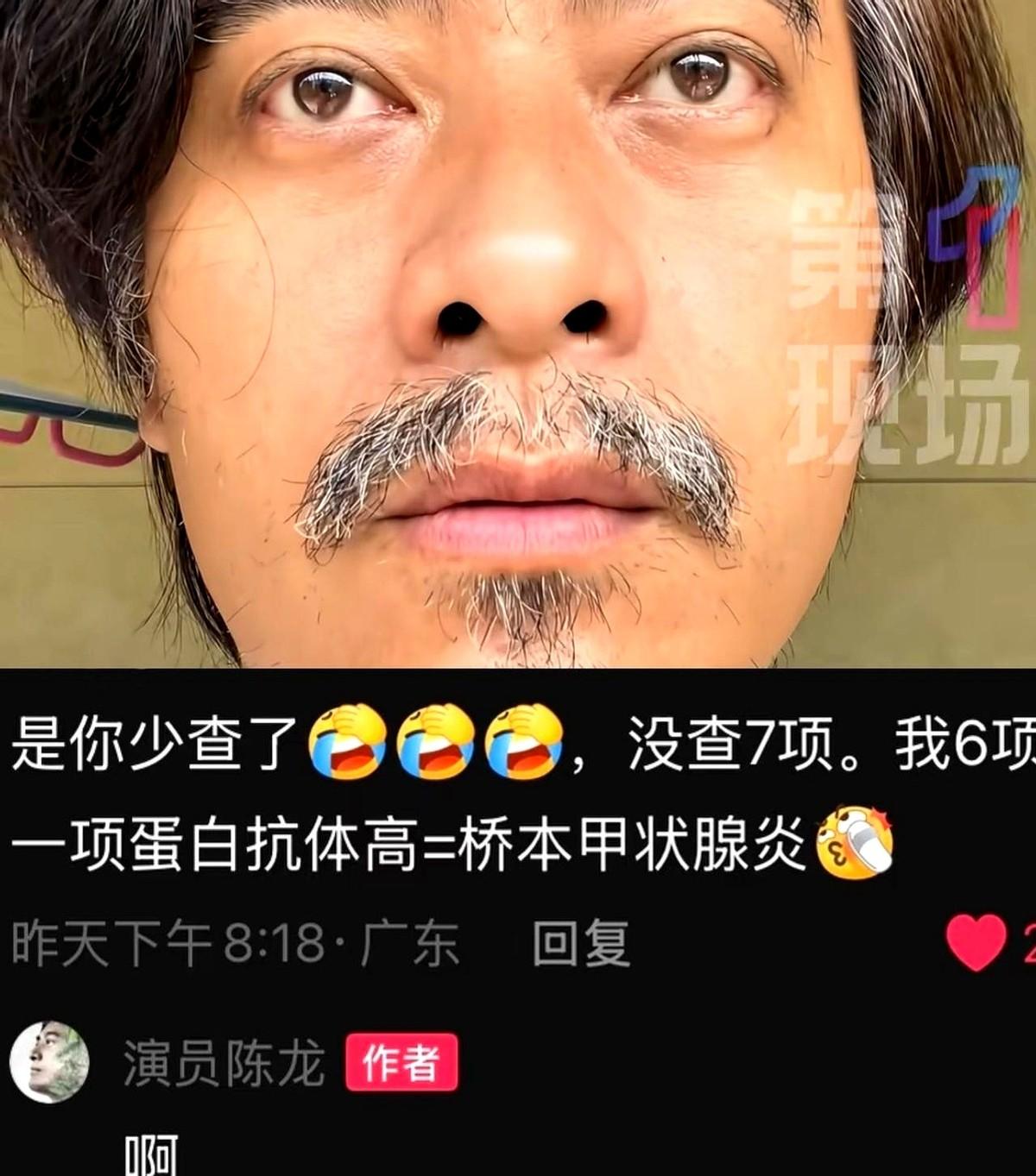 中年人交友的最高礼仪是什么？
不是请你喝顿大酒。
而是盯着你的脸，冷不丁来一句：