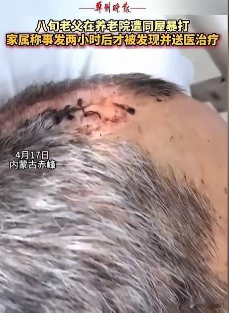 内蒙古赤峰，女子将丈夫送到养老院，几天后接丈夫，只见丈夫裤子直接裂开到裤裆，上衣