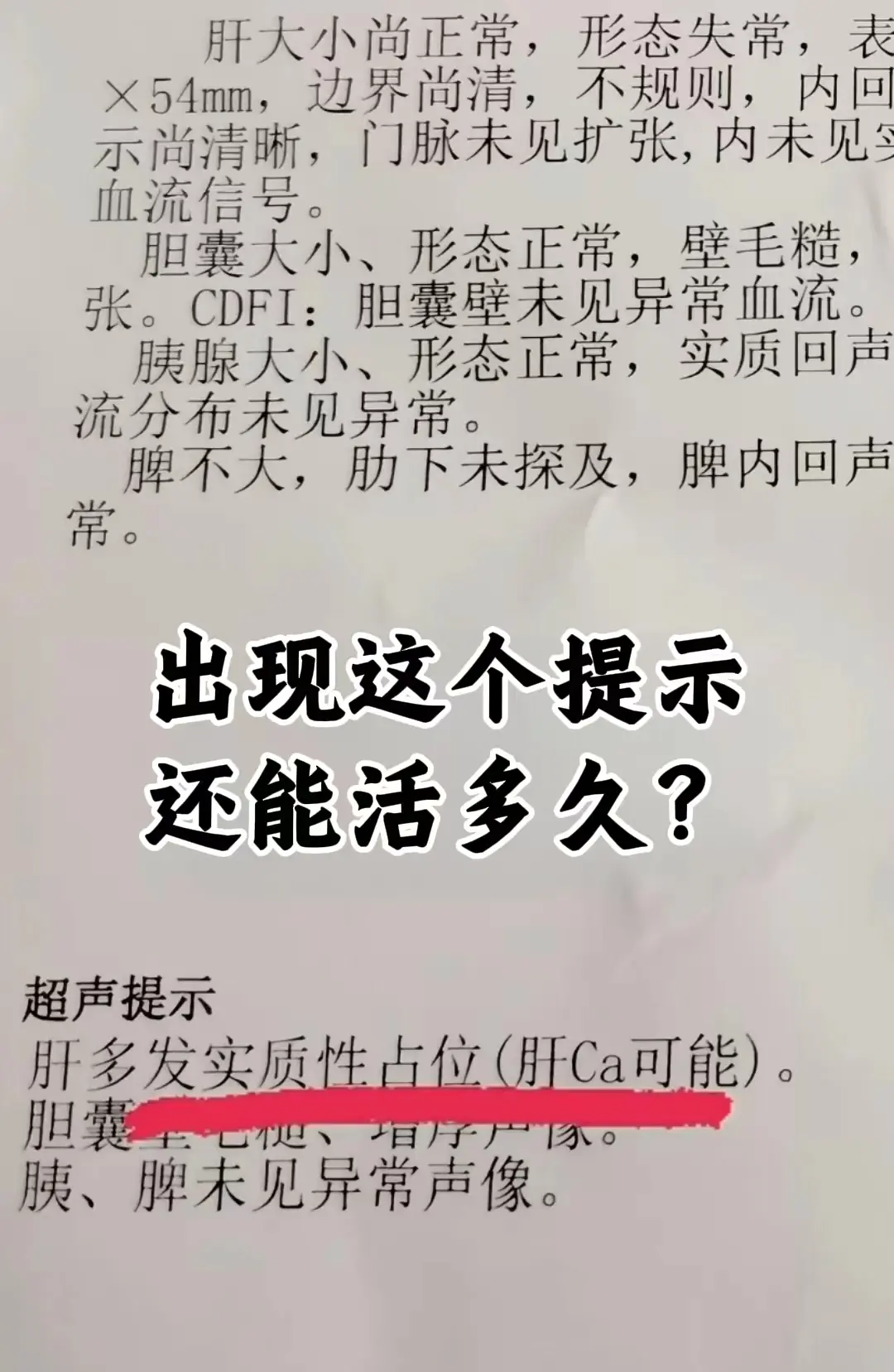 前几天有济宁老乡给我发来了这张单子，说自己查了查Ca的意思，想问问自己...