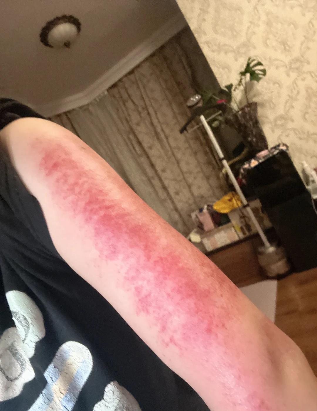 大面包好用
疏通经络对人体的好处