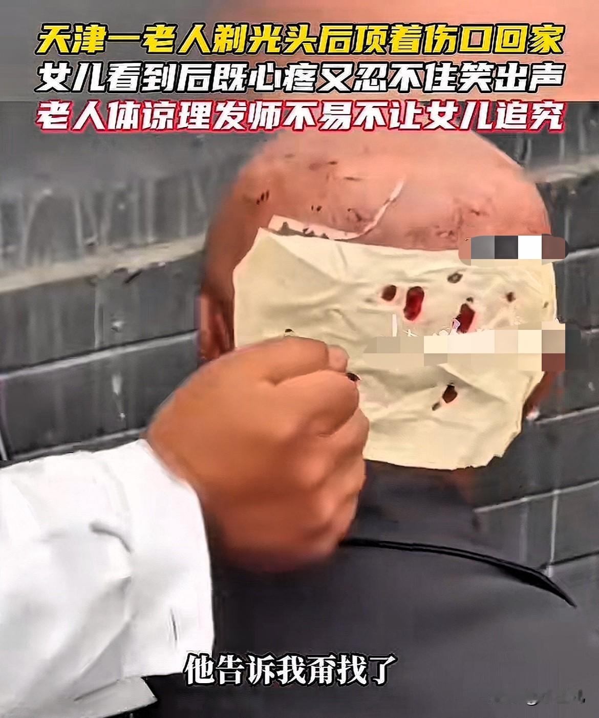 这也太荒唐了！天津一位67岁大爷，去一家小理发店花了10块钱剃头，结果理发师手生