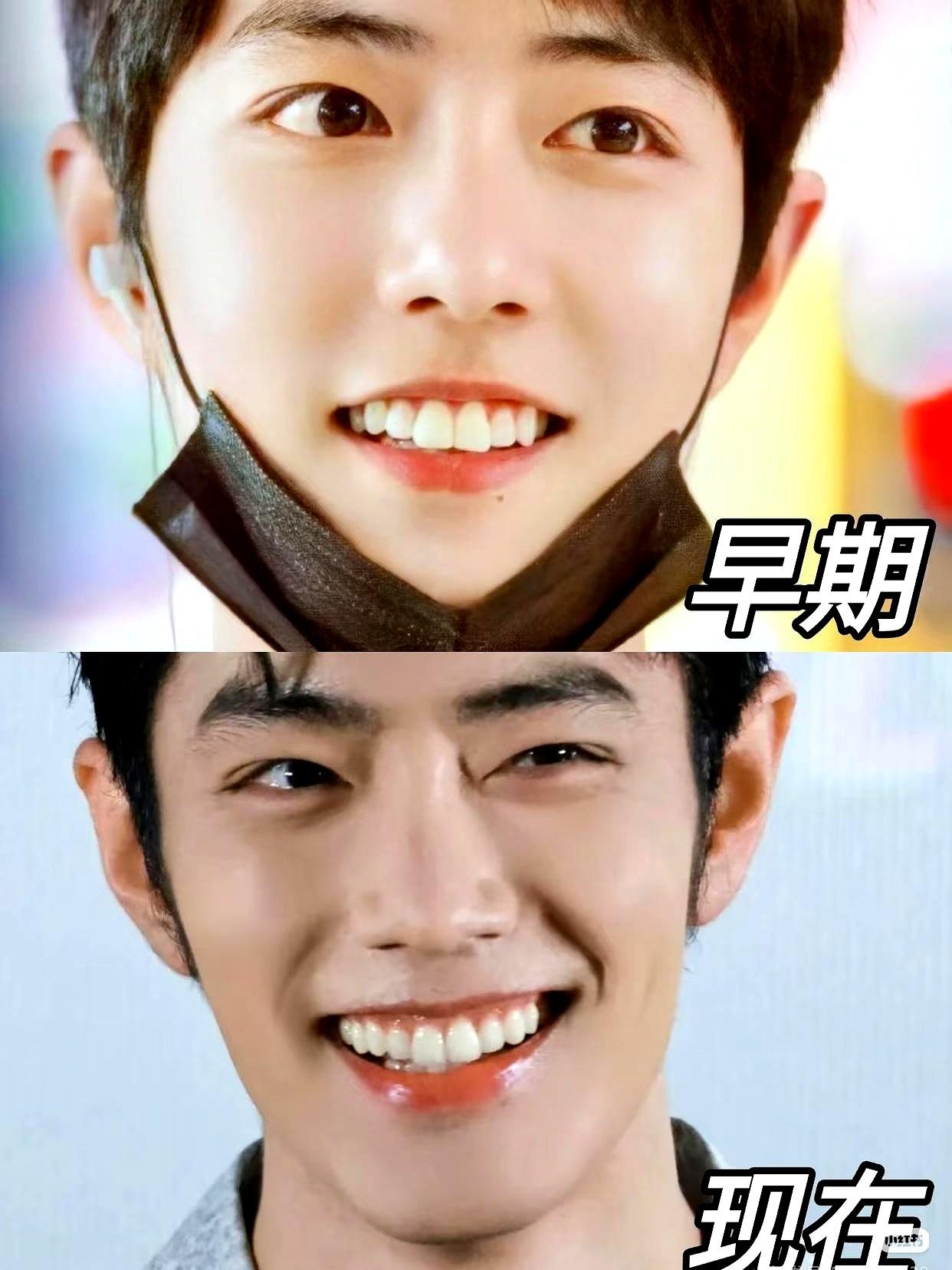 别光盯着肖战的身材了，他这次真正让人眼前一亮的，其实是牙齿和笑容。
说白了就是，